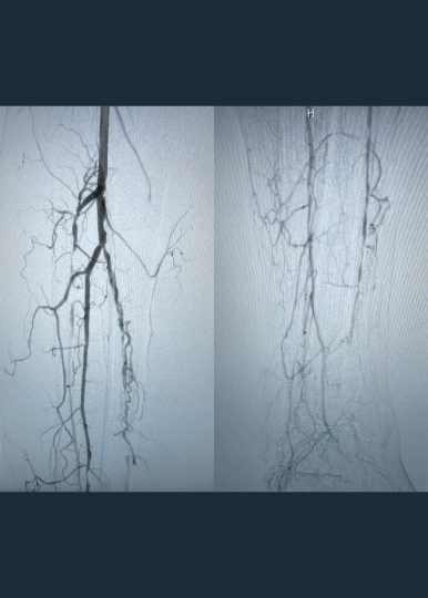 Dr. Mazin Foteh’s E8 Case