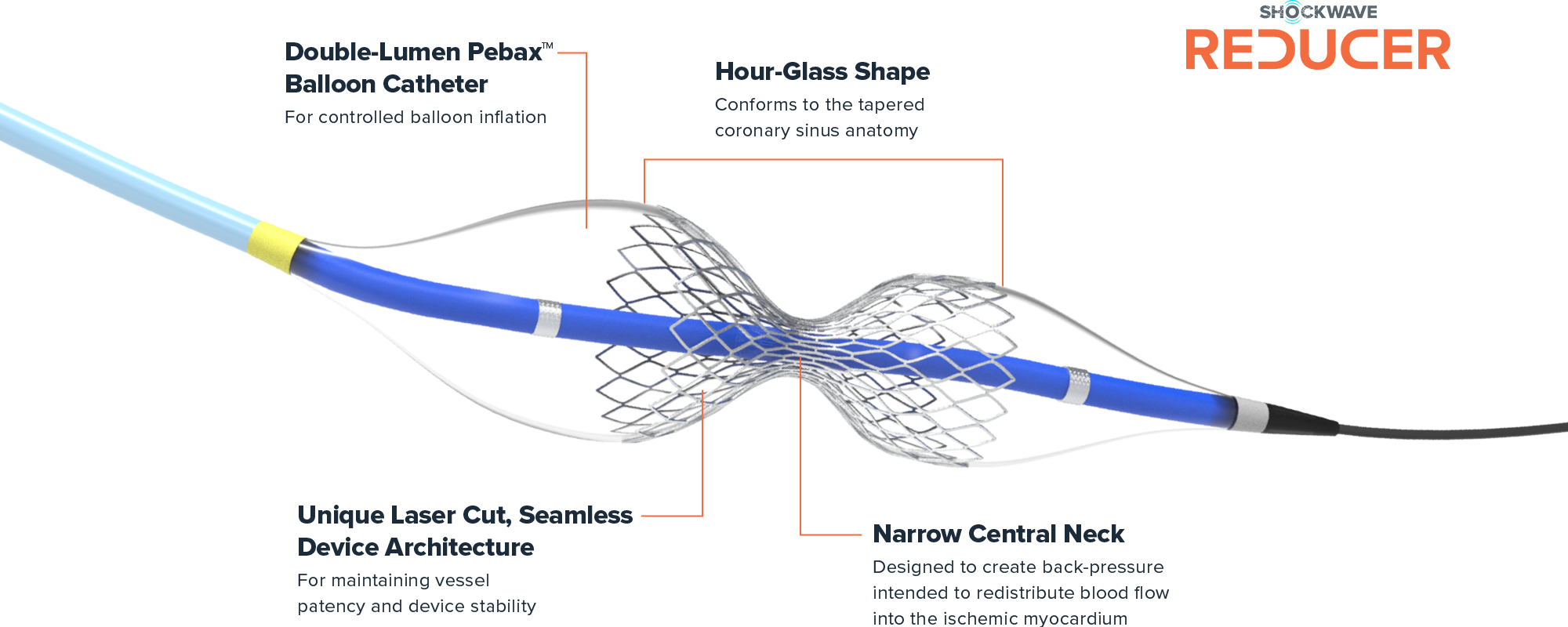 Digitally rendered image of Shockwave Reducer device showing the balloon catheter and the narrow central neck. 