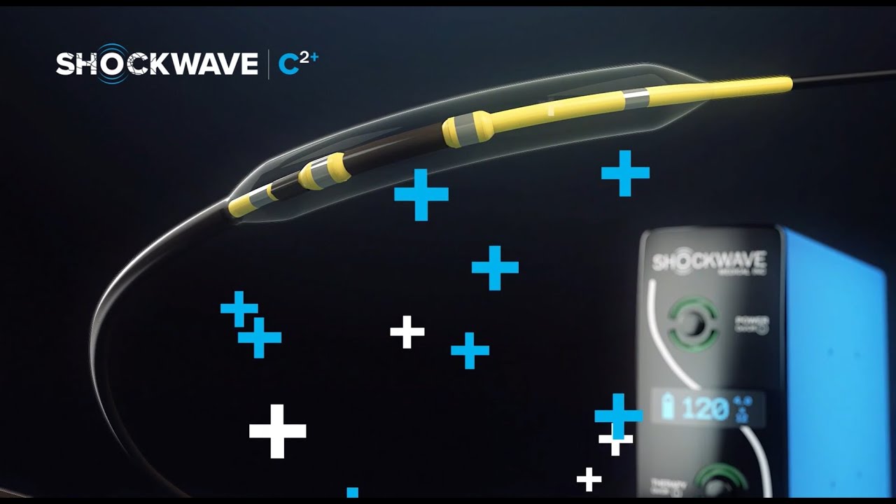 Shockwave C2+ IVL Animation (Global)