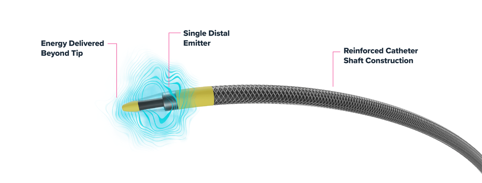 Close-up image of the Shockwave Javelin Peripheral IVL catheter tip, including the single distal emitter and reinforced catheter shaft. Image includes illustrated sonic pressure waves to show how energy is delivered beyond the tip of the catheter