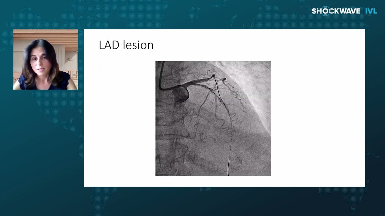 Image for Consistent Results Regardless of Complex Anatomy