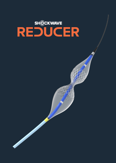 Road to Relief: Effective Treatment of Refractory Angina Patients with Shockwave Reducer