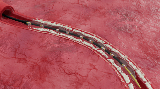 Image for Ready for the next step