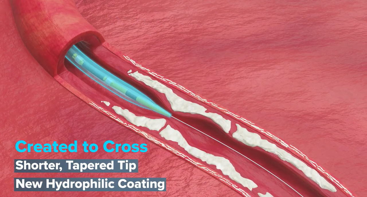 Introducing Shockwave C2 Aero